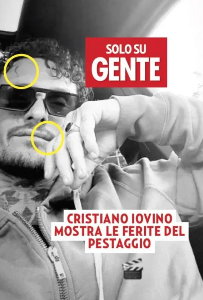 Cristiano Iovino mostra le ferite dopo l’aggressione 2