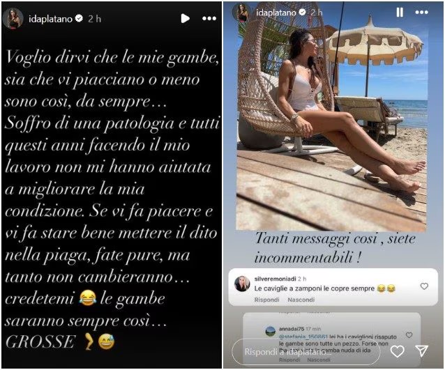 Uomini e donne, Ida criticata per una parte del corpo, lei rivela di avere una patologia 2