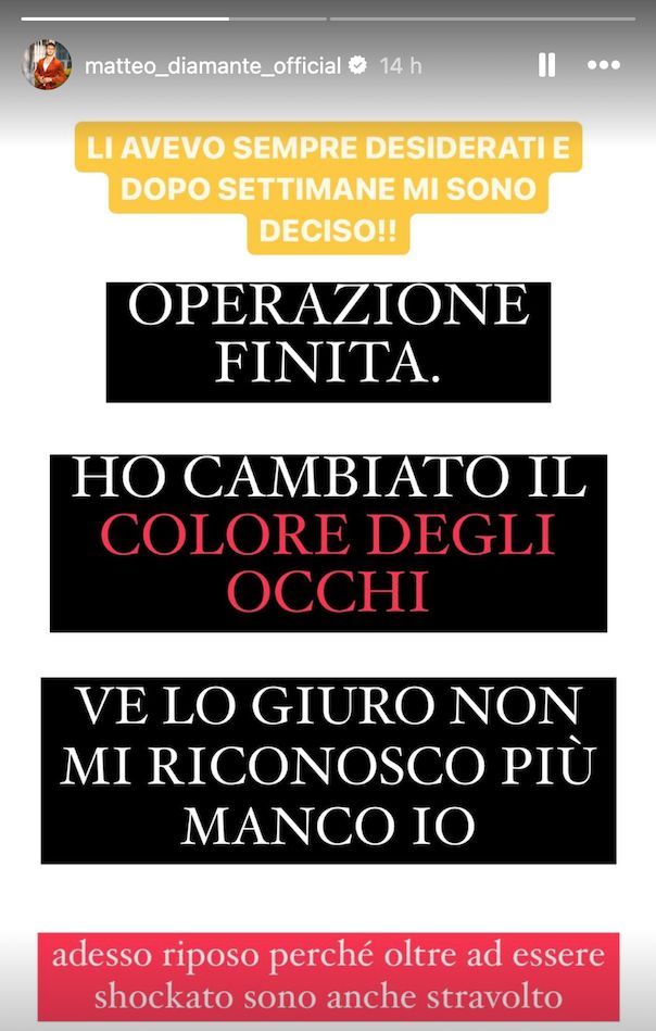 Un ex concorrente dell’isola dei famosi si opera agli occhi 3